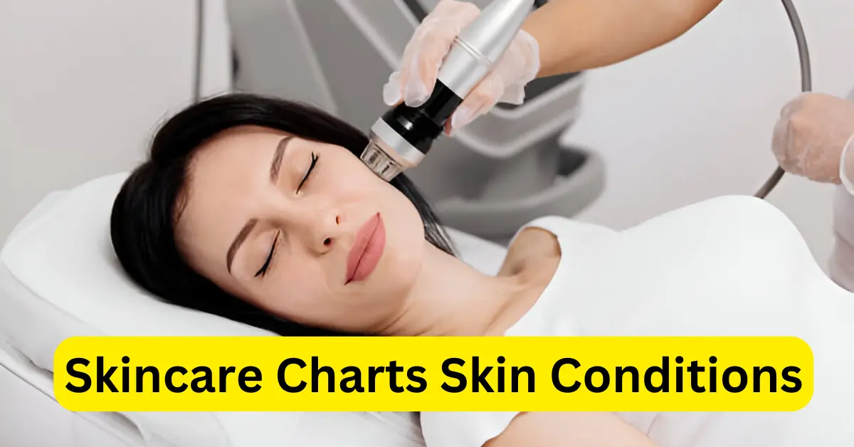 Skincare Charts Skin Conditions